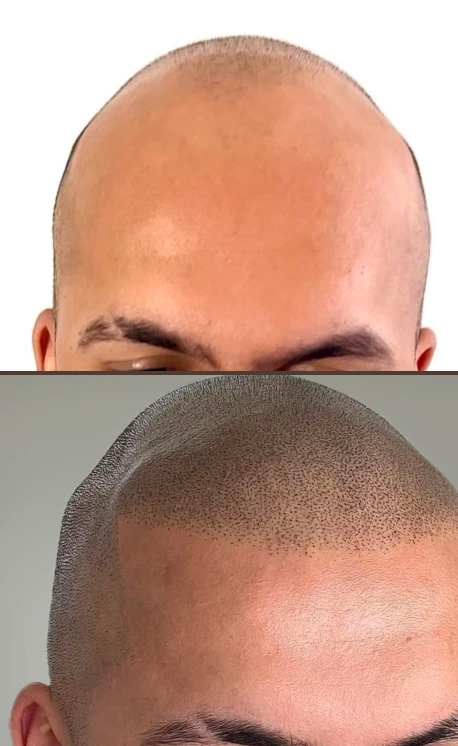 antesdepois_1